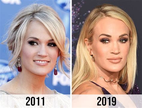 Did Carrie Underwood Have Plastic Surgery? Exploring the Rumors and Realities