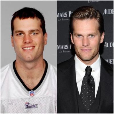 Does Tom Brady Have Plastic Surgery? Exploring the Rumors and Realities